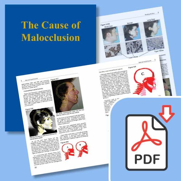 The Cause of Malocclusion - E-Book