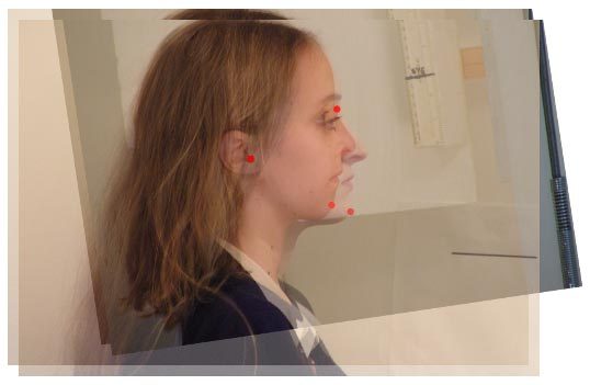 Superimposed side of the face photos